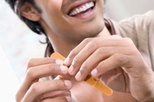 How to Treat Nail Eczema