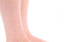 Unexplained Shooting Pain in My Shins