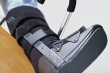 Rehabilitation of a Fractured Heel Bone