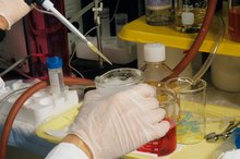 Causes of a False Positive HIV Test