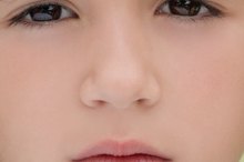 Small White Bumps on the Nose