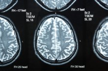 What Do the Parts of the Brain Control?