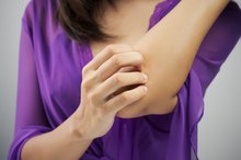 Reasons for Itching Under Skin