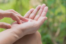 Peeling Skin on Hands & Fingers
