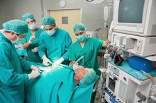 What Are the Side Effects of Gallbladder Removal?