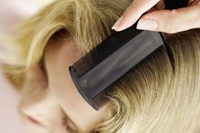How to Treat Head Lice With Cetaphil