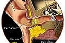 How to Remove Ear Wax