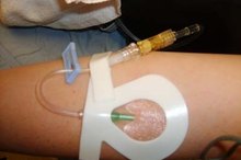 What Is a Heparin Lock?
