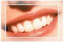 What do Partial Dentures Cost?