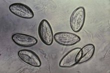 How to Clean a House of a Pinworm Infestation