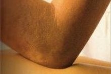 How to Treat Elbow Tendonitis