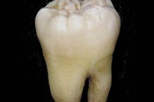 How to Stop Wisdom Tooth Pain with Pressure Points