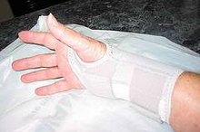 What Causes Burning Sensations in Fingertips?