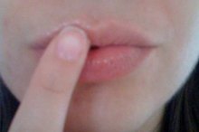 How to Get Rid of Cold Sore Scabs
