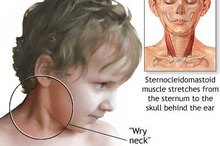 Causes of Facial Asymmetry