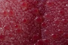 Causes of Small Bumps on the Tongue
