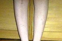 How Far Should Someone Walk After Knee Replacement Surgery?