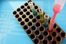 What Is a GGTP Blood Test?