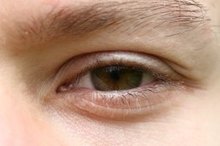 Homemade Eye Drops