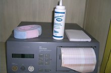 How to Read a Fetal Monitor Strip