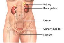 What to Do With a Pulled Groin on a Woman?