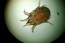 Can You Get Scabies From Playing in the Dirt?