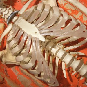 Arm Exercises With Sternal Precautions