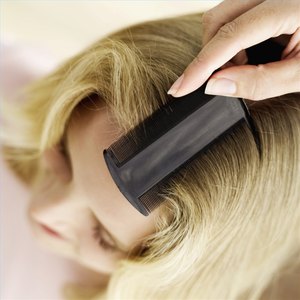 How to Treat Head Lice With Cetaphil